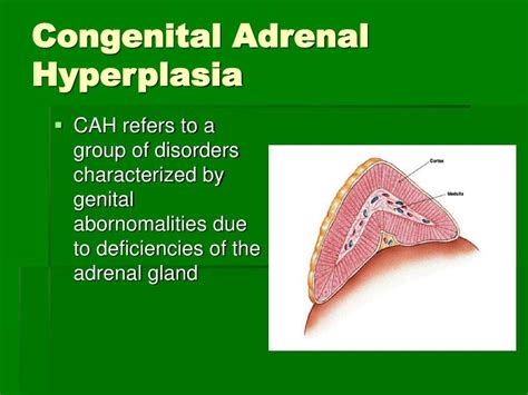 Congenital Adrenal Hyperplasia