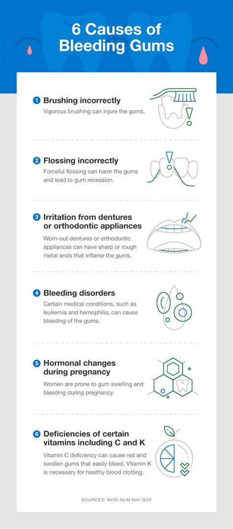 Bleeding Gums: Causes, Treatment, and Prevention - SmartMouth