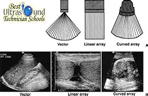 Types Of Ultrasound Imaging – Best Ultrasound Technician Schools