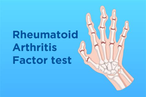 Rheumatoid Arthritis (Ra) Factor Test: Diagnosis and Purpose