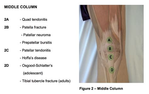 Tibial Tubercle Palpation