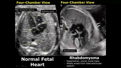 ISUOG Practice Guidelines (updated): Sonographic Screening, 45% OFF