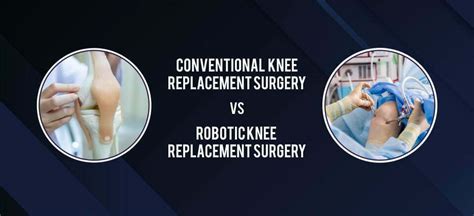 Conventional VS Robotic Knee Replacement Surgery - AH