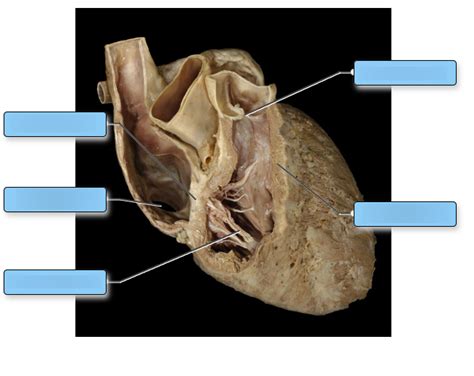 Labeling the Cadaver Heart: Internal Anatomy 1 Diagram | Quizlet