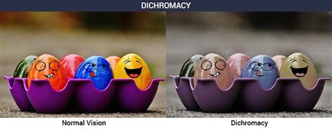 Colour Blindness - Causes, Symptoms, Diagnosis with the Treatment