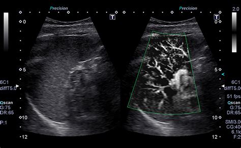 Ultrasound | Canon Medical Systems USA