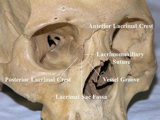 Fossa For Lacrimal Sac