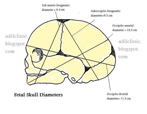 Fetal Skull Diameters, Diameter Of Skull Of Fetus at Time Of Delivery,