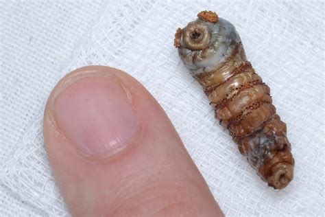 File:Human Botfly (Dermatobia hominis) larva - Lima, Peru - Sept. 2013.jpg - Wikimedia Commons