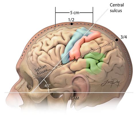 Scalp Incisions | The Neurosurgical Atlas