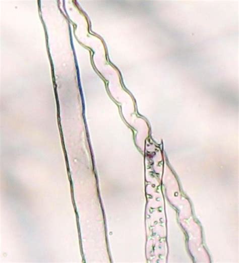 What are rhizoids? Function, structure, morphology