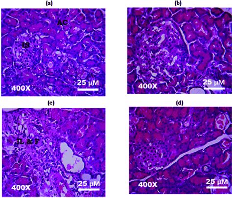 Histology of the pancreas (H&E stain, 400X): (a) & (b) Photomicrograph ...