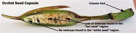 orchid-seed-capsule-showing-embryos » Here But Not