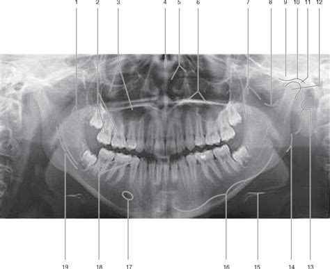 Panoral anatomy Diagram | Quizlet