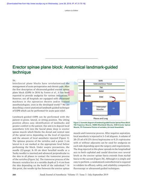 (PDF) Erector spinae plane block: Anatomical landmark-guided technique