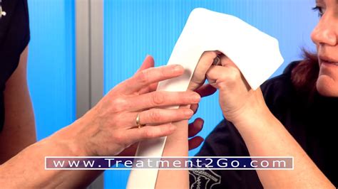 Splint in the Spotlight: Dorsal Blocking Orthosis - Orfit Industries