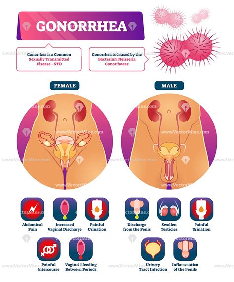 Pin on Health and medicine illustrated