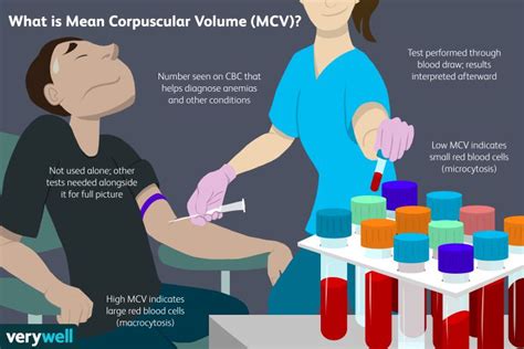 Mean Corpuscular Volume (MCV) Blood Test