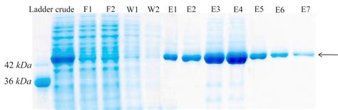 Protein purification with Ni-NTA agarose resin. F1-F2: different ...