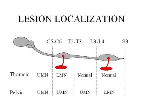 Spinal cord diseases: overview in dogs | Vetlexicon Canis from ...