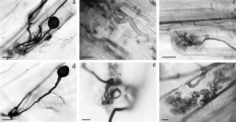 Arbuscular mycorrhiza in roots of L. paniculatum (a-c) and E. bogotense ...