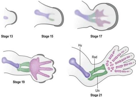 Pin by The Hand Center of Western Ma on limb embryology | Principles, Classification, Hands