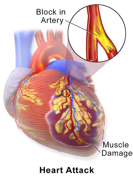 Achy Breaky Heart – BIOL312 @UNBC – Molecular Cell Physiology