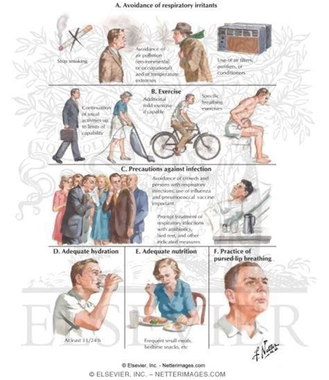 General Measures in Management of Chronic Obstructive Pulmonary Disease