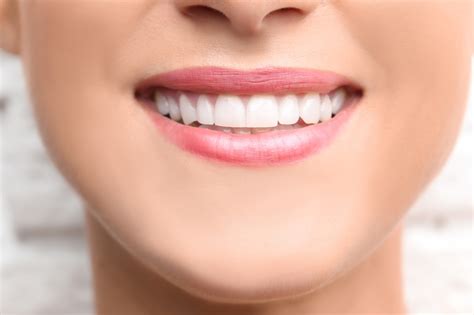 Teeth Bonding 101: Everything You Need to Know About the Procedure