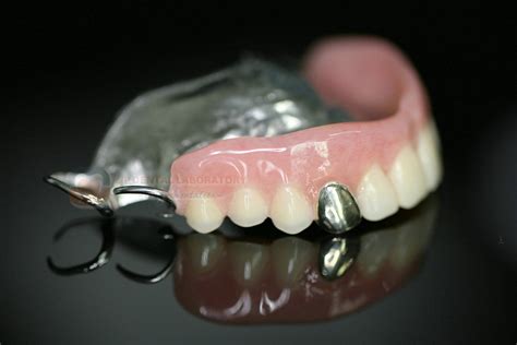 Metal-based Dentures-Shenzhen Zhiya Technology Co., Ltd