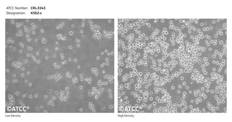 K562-s - CRL-3343 | ATCC