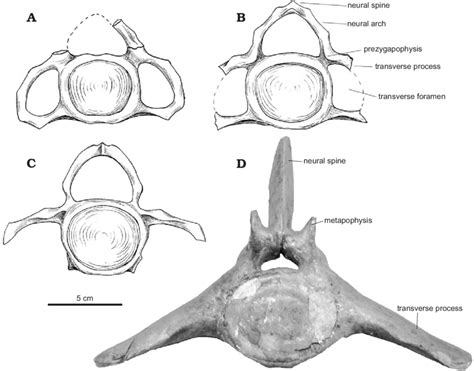 Selected vertebrae of the cetotheriid baleen whale Cetotherium... | Download Scientific Diagram