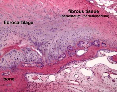 Fibrocartilage Histology