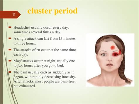 cluster headache, what you need to know?