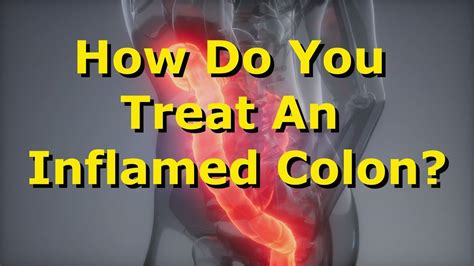 How Do You Treat An Inflamed Colon? - YouTube