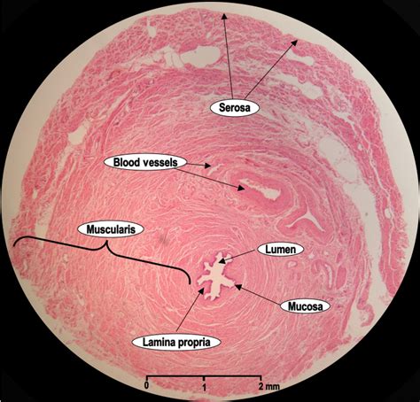 HistoQuarterly: FALLOPIAN TUBE | Histology Blog