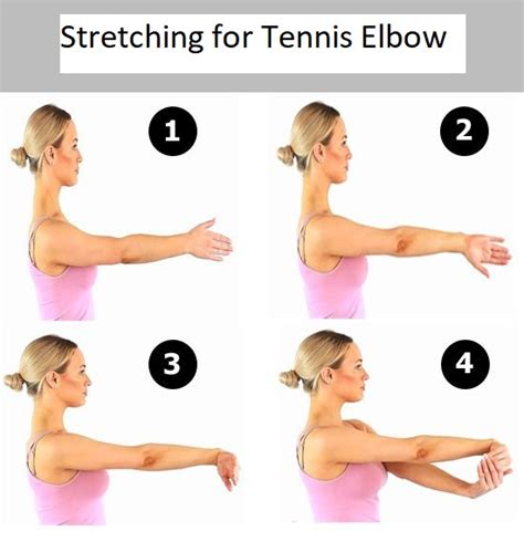 Lateral Epicondylitis: Tennis Elbow Causes, Symptoms, Treatment » How ...