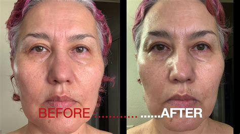 Retinol Anti Aging Face Cream. BEFORE & AFTER. REVIEW after 7 days of use. - YouTube