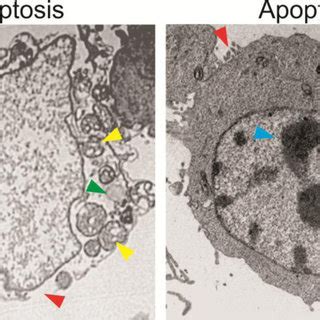 Morphological features of necroptosis and apoptosis in cancer cells... | Download Scientific Diagram