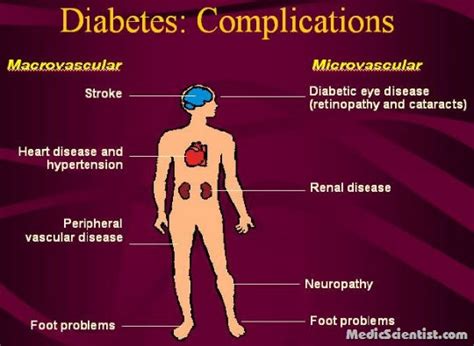 Diabetes Mellitus: Complications – Diabetes Research