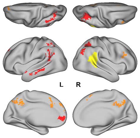 The posterior superior temporal sulcus (pSTS) region-of- interest (ROI)... | Download Scientific ...