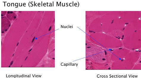 Skeletal Muscle Histology Labeled