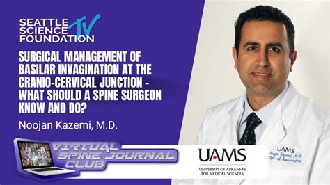 Surgical Management of Basilar Invagination at the Cranio-Cervical Junction - Noojan Kazemi, MD ...