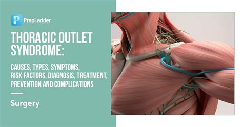 Thoracic Outlet Syndrome: Causes, Types, Symptoms, Risk Factors, Diagnosis, Treatment ...