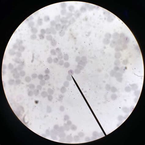 Plasmodium falciparum with gametocyte smear prepared microscope slides