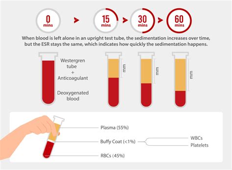 Hemabook Chapter 14: Quick Facts About Erythrocyte Sedimentation Rate ...