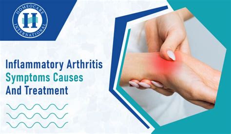 Inflammatory arthritis symptoms causes and treatment ‣ Arthritis | Homeocare International