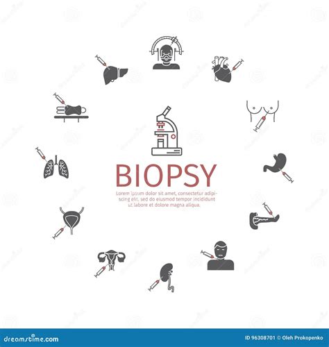 Biopsy: Types Of Biopsy Procedures Used To Diagnose Cancer Stock Image | CartoonDealer.com #96308701