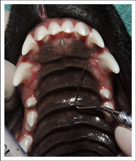 Figure 1 from Assessment of Extractions of Deciduous Mandibular Canine ...