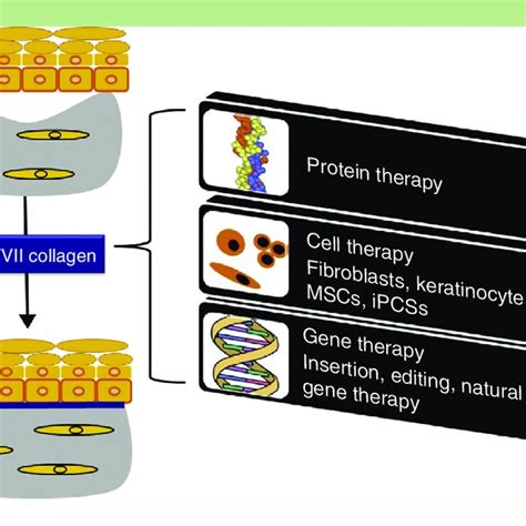 Treatment strategies for recessive dystrophic epidermolysis bullosa.... | Download Scientific ...